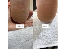 ニマ(nima)の雰囲気（1回で即実感のフットケア&フットネイル両方の施術が可能！）