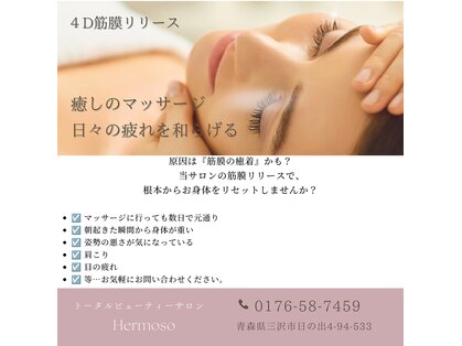 エルモソ(Hermoso)の写真
