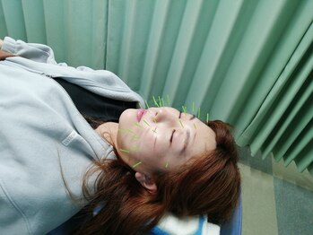 東陽町駅前たけだ整骨院 鍼灸院 整体院/美容鍼