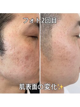 リエル(RIEL)/【フォト】