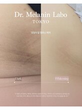 ドクターメラニン ラボ トーキョー 渋谷(Dr. Melanin Labo TOKYO)/お尻の下メラニンケア症例