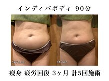 ヒロアフロムベラーノ(HIROA From Verano)の雰囲気（結果重視◎整体由来のインディバケアで骨格ダイエット！）