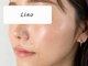リノ(Lino)の写真/＼26年9月プレオープン／今話題の【剥けないハーブピーリング】で肌質改善♪プレオープン期間でお得に体験
