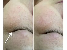 クラティス(CRATIS)/