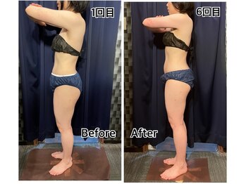 トリニティ 池袋店(TRINITY)/二の腕もスッキリ