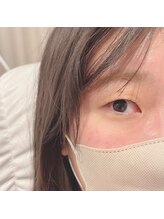 サンライズ(SUNRISE)/