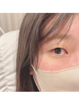 サンライズ(SUNRISE)/