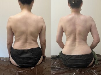 リセット(Reset.)/深層筋リンパ/ before → after