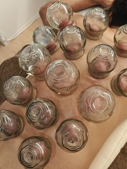 リス(R.i.S)/伝統カッピング