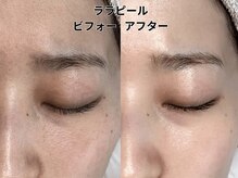 トゥミー 大宮店(to/me)/ララピール