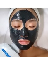 シャルム ド ケー(charme de k)/ブラックピーリング