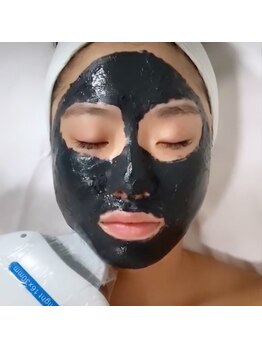 シャルム ド ケー(charme de k)/ブラックピーリング