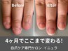 深爪・爪かみ改善！ネイルケアプログラムの初回体験