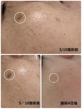 ベルエクラ(Bel Eclat)/当店イチオシNO1おもろまち駅近