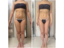 セルビューティー(Cell Beauty)の雰囲気（筋膜リリースで全身の皮下循環を整え、サイズダウン☆体質ケア☆）
