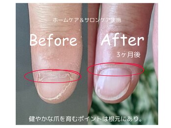 セル(Cell)/ネイルケア