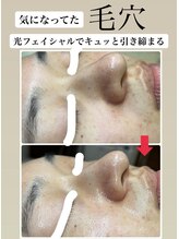 顔凛(カオリン)/毛穴もキュッと改善