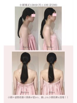 トゥインクル 麻布(twinkle)/麻布十番/シンメトリー小顔矯正