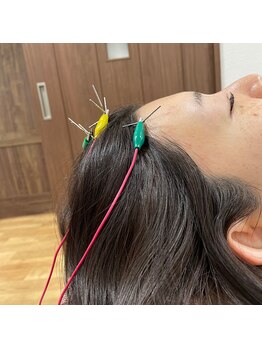 キャンディ鍼灸整骨院/施術風景