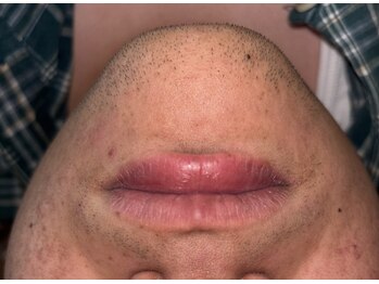 ベルフィオーレ(bel fiore)/20代男性 初回