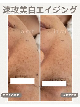 ラシュール(la sur)/