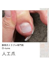 オツメ 静岡(O-tume)/人口爪