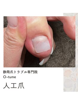 オツメ 静岡(O-tume)/人口爪