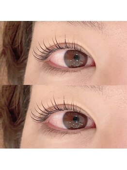 エン(EN)/ラッシュアディクト使用