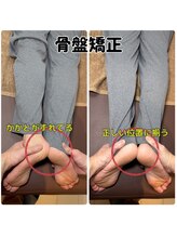 ライトワーク 西新宿店/骨盤を整えて脚長差も揃える