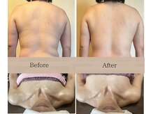 CBDサロン ローズ(ROSE)の雰囲気（オススメはまずは筋膜リリース。根本改善ゴールを目指します。）