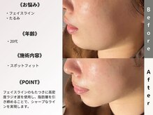 ルディラ 横浜店/スポットフィット