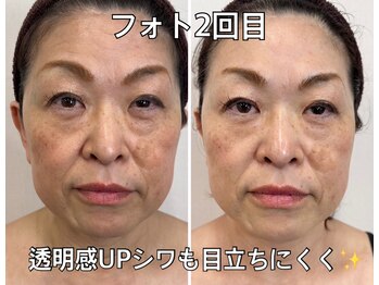 リエル(RIEL)/【フォト】