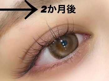 ジラッシュ(G/ash)/【パリエク】2か月後