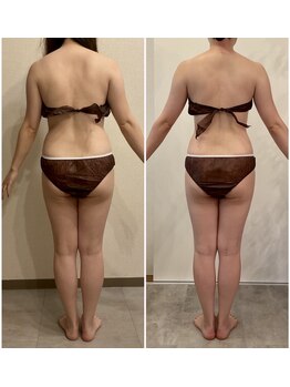 セカンド ニコ(2nd nico)の写真/絶対に痩せしたい人必見!!満足度★五つ星《セルゼロ痩身+深層筋360°フルBODY》ボディラインも爆上げ★