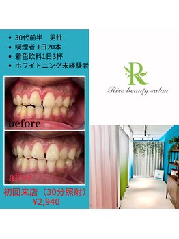 ライズビューティーサロン(Rise Beauty Salon)/☆ビファーアフター☆