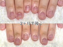 グレースレディ 大阪店/(深爪/長さだし/フィルイン)