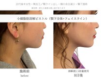 サボラミ(sabor A Mi)/溶解液増量で直近のご予定にも◎