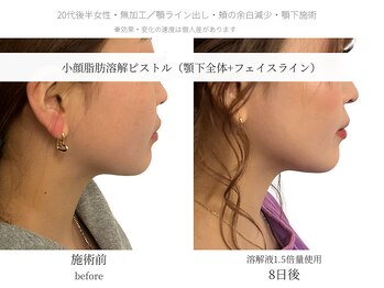 サボラミ(sabor A Mi)/溶解液増量で直近のご予定にも◎