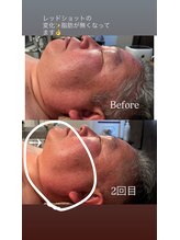 白美/レッドショット2回目の変化