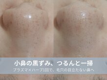 ラシック 加古川店(La chic.)/頑固な角栓・ざらつきを徹底ケア