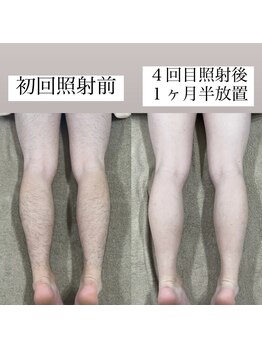テンパ ビューティー(+10%beauty)/効果写真