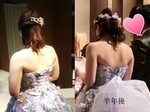 トータルビューティー メルシームーン(Merci Moon)/美背中☆天使の羽と華奢な腕！