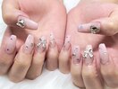 チップスカルプ