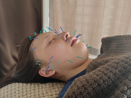 東京鍼灸整骨院の写真