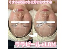 サロン(SALON)/ララピール+LDM