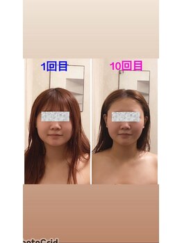 スモール フェアリー(Small Fairy)/小顔矯正+リンパマッサージ