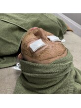 クラリ(Clari)/ハーブピーリング/肌質改善