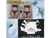 ソユラ(SOYURA)の雰囲気（新型caviZERO＋RF機器＆強圧ハンドリンパで痩身・筋肉疲労も◎）