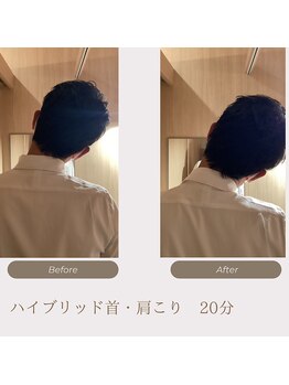 サロン ド メディセル(salon de Medicell)/ハイブリット肩ビフォーアフター