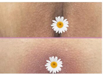 吉乃 大和高田有井店/ローマピンク　【大陰唇】